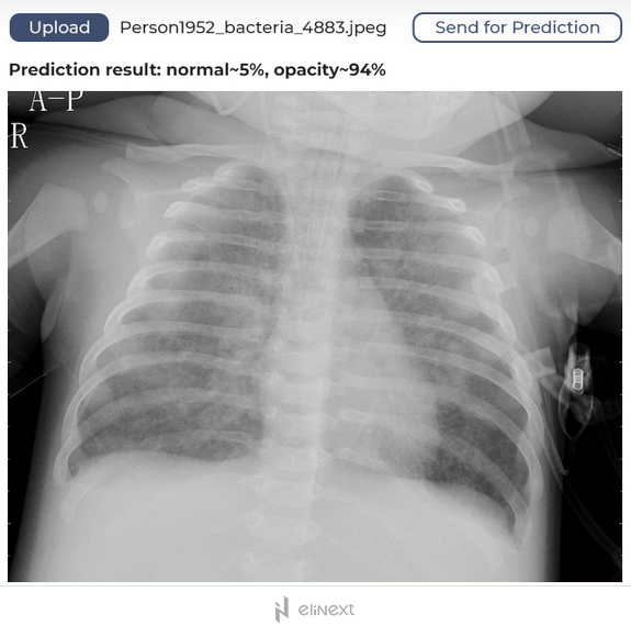 An automated pneumonia diagnosis tool An automated pneumonia diagnosis tool