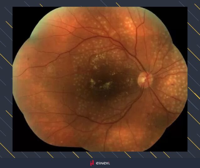 The next step is to lead the experiment and examine the model in practice for a patient from a real medical clinic